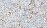 PD-L1 IHC 22C3 pharmDx product teaser image