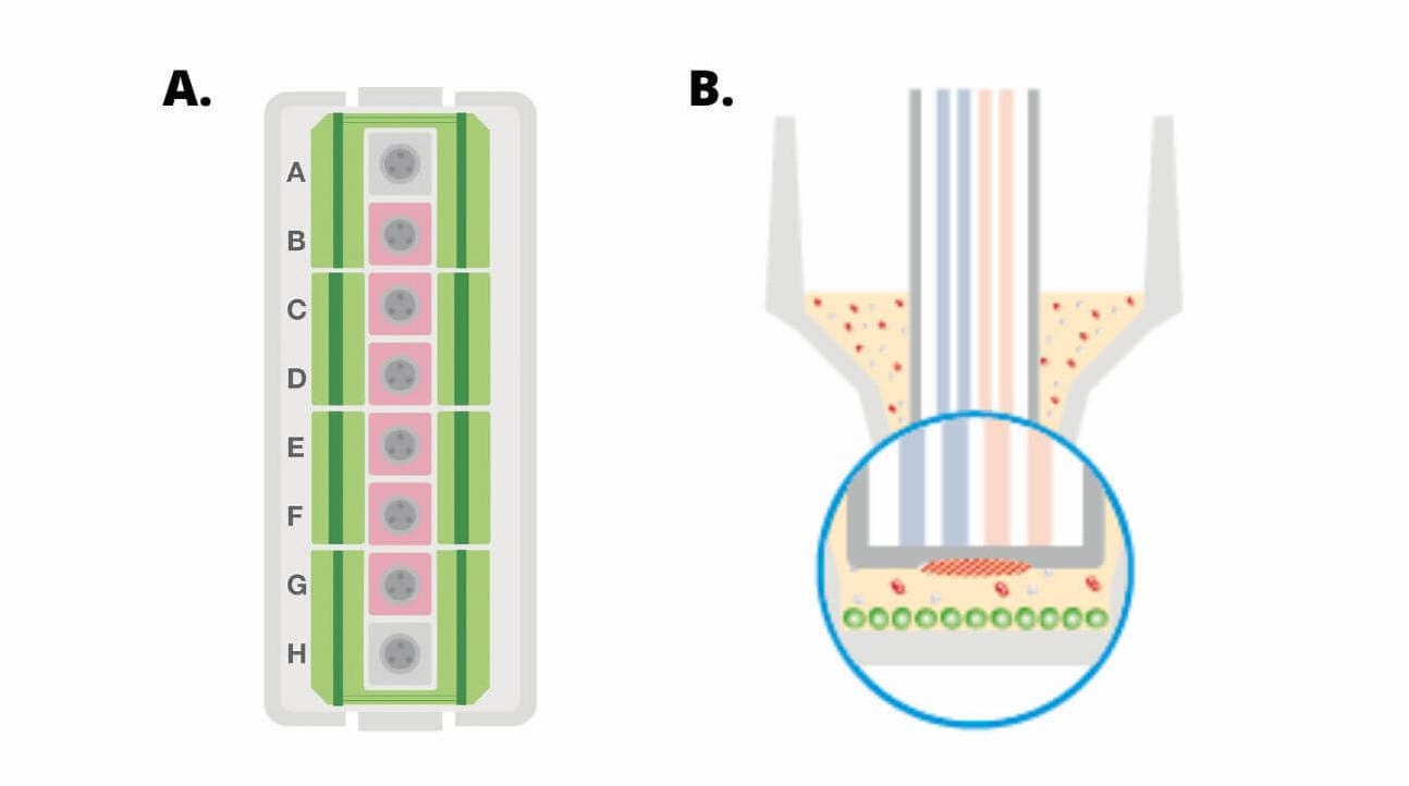 XFp miniplate