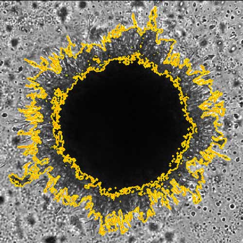 3D spheroid