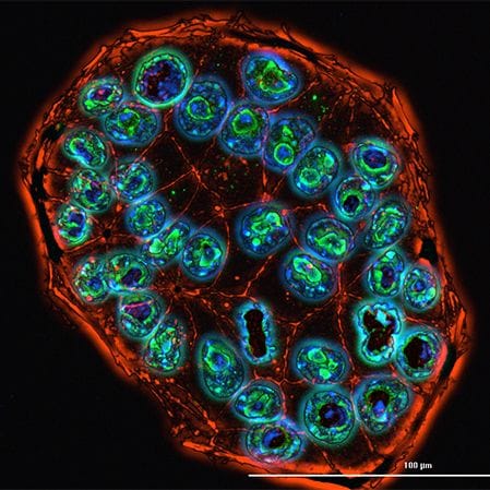 Filamentous-actin