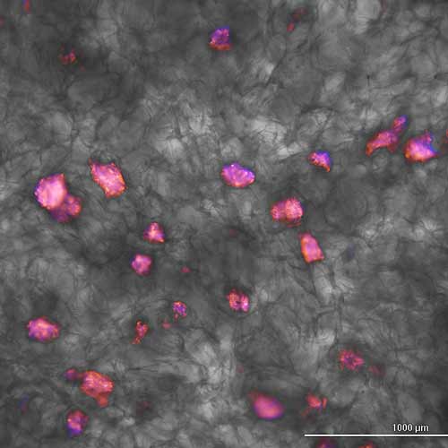 Ca-CHA biomaterial scaffolds