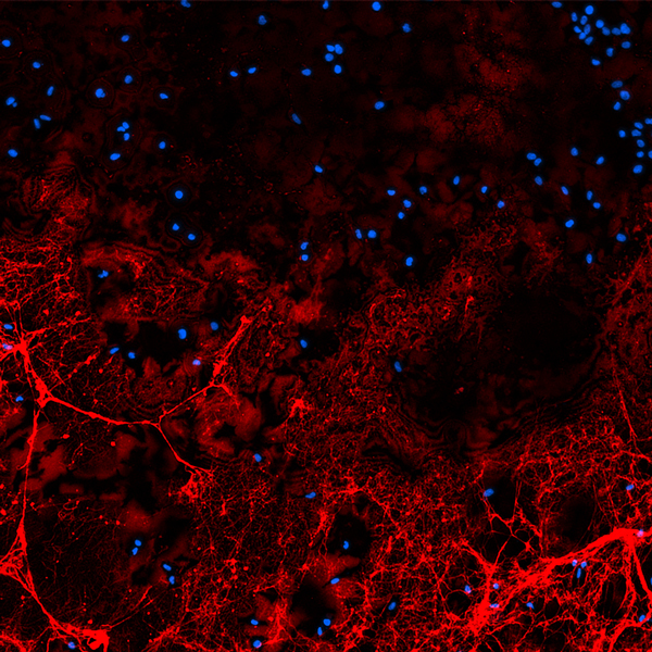 A 96-well fibrin/mesothelial cell assay with nuclear stain (Hoechst) and fibrin stain (647); moreover, images were taken at 4X. Image captured with: Cytation 5