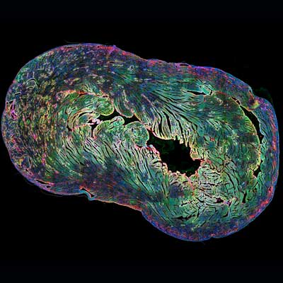 Neural crest-derived stem cells in a fluorescent labeled heart tissue section