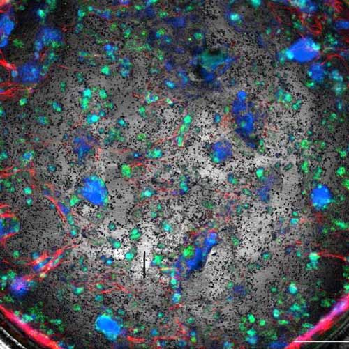 Mesenchymal/epithelial spheroid assay