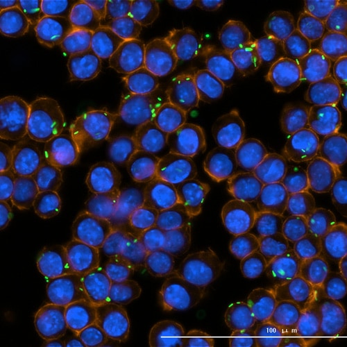 Listeria infection Raw 264.7(fixed slide sample), and different phases of cell cycle can be found in this picture