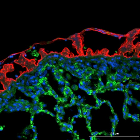 Rabbit lung, 20x