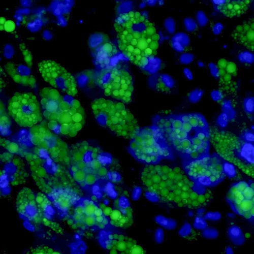 Simpson Golabi Behmel Syndrome (SGBS) adipocyte cells stained with BODIPY and Hoechst 33342.