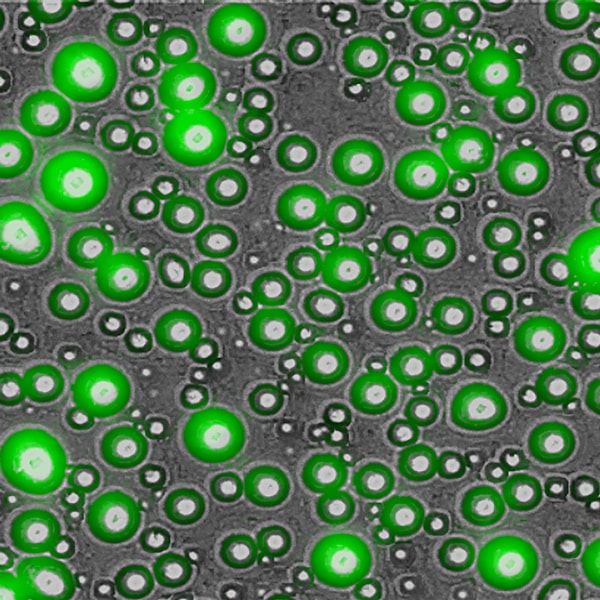  Phase Separated Fluorescein Tagged Hypophosphorylated SRSF1, 60x, GFP/brightfield overlay. Image captured with: Cytation 5 by Talia Fargason, University of Alabama at Birmingham