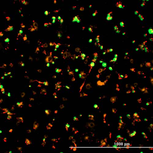 death pathway assay