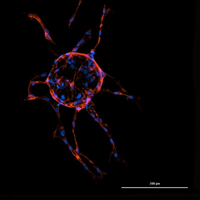 Mouse e7.5 implantation site imaged at 10x