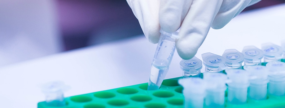 RNA Analysis with the Agilent Automated Electrophoresis portfolio