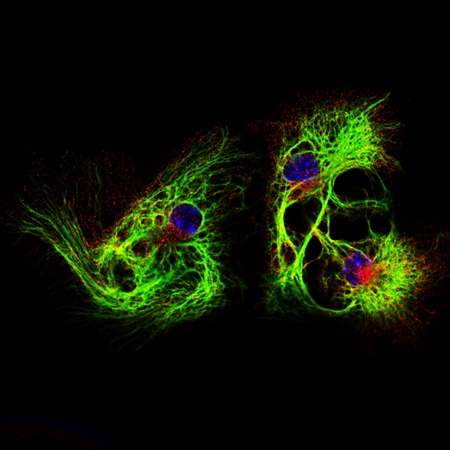 Ibrahim Halil Demirsoy Stem cell- derived neural cells