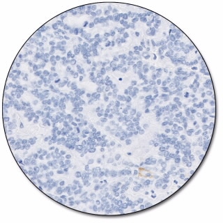 PD-L1 IHC 22C3 pharmDx for Autostainer Link 48