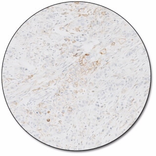 PD-L1 IHC 22C3 pharmDx for Autostainer Link 48