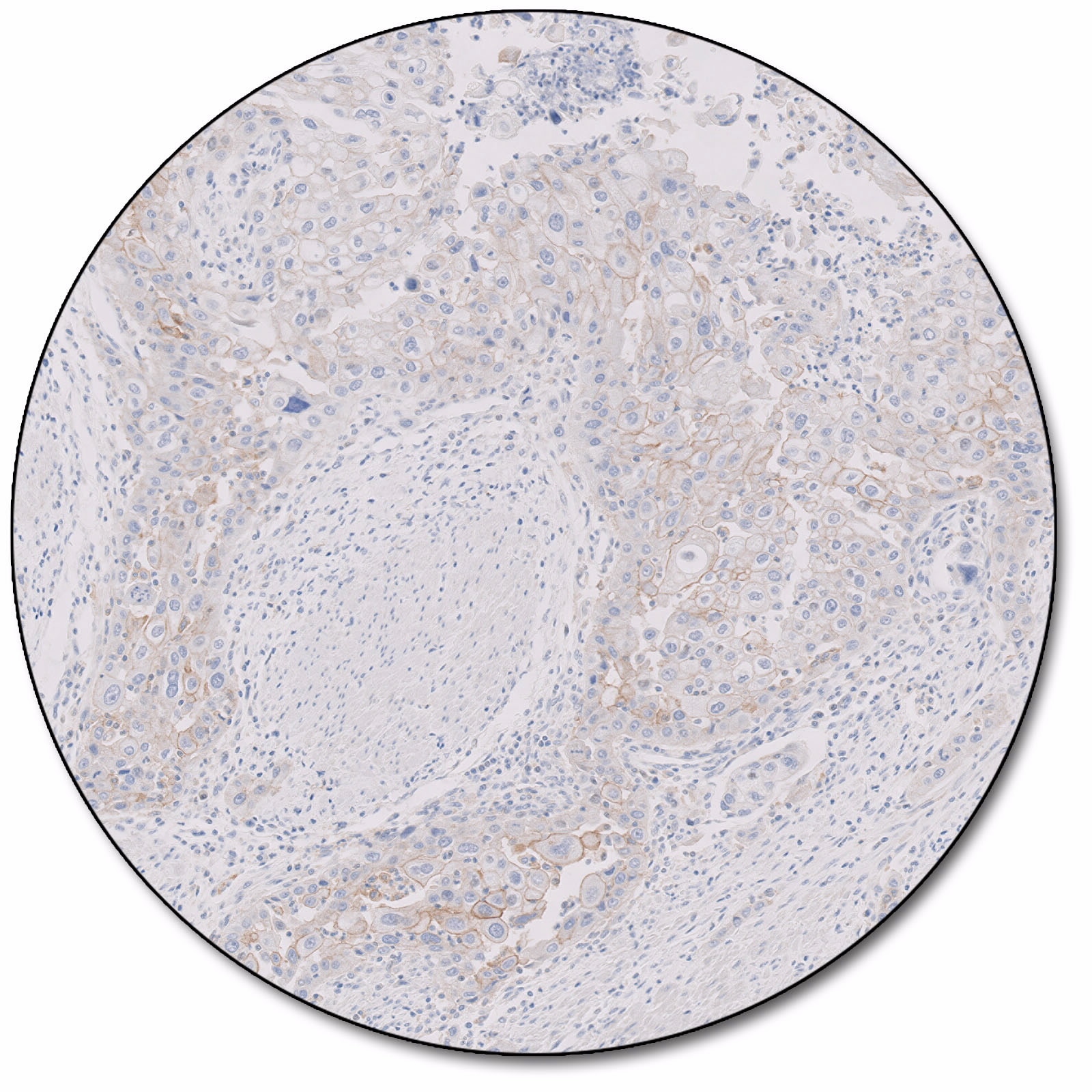 PD-L1 IHC 28-8 pharmDx for Autostainer Link 48