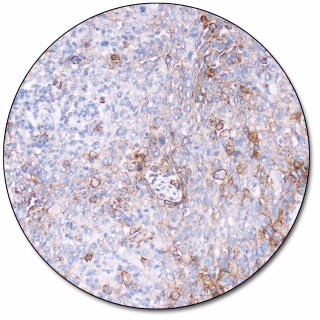 PD-L1 IHC 28-8 pharmDx for Autostainer Link 48