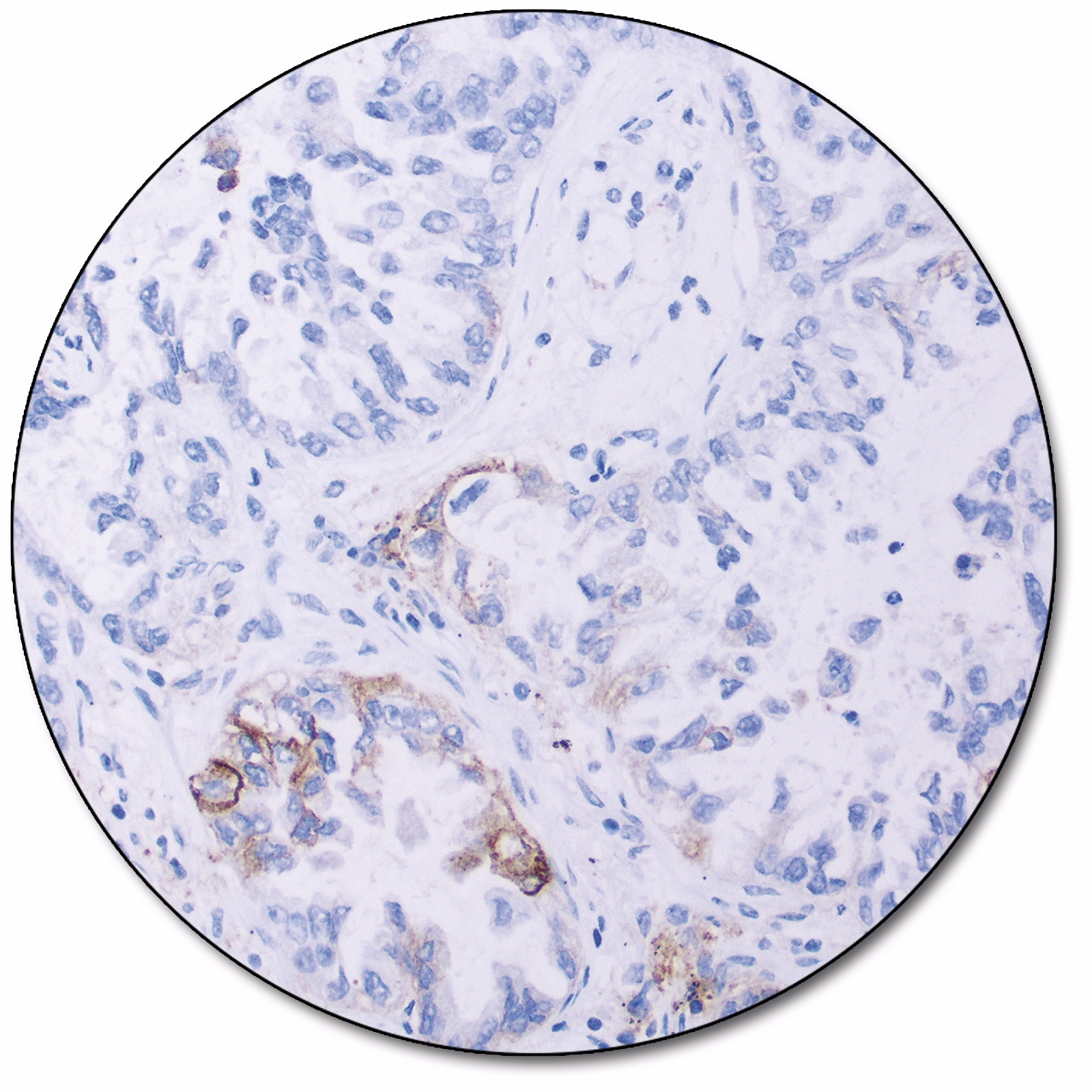 PD-L1 IHC 28-8 pharmDx for Autostainer Link 48