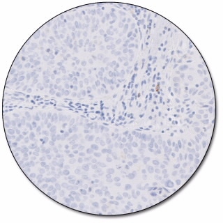 PD-L1 IHC 22C3 pharmDx for Autostainer Link 48