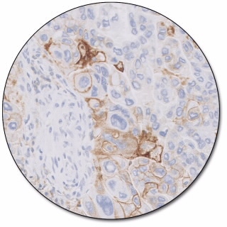 PD-L1 IHC 22C3 pharmDx for Autostainer Link 48