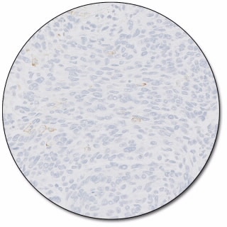 PD-L1 IHC 22C3 pharmDx for Autostainer Link 48