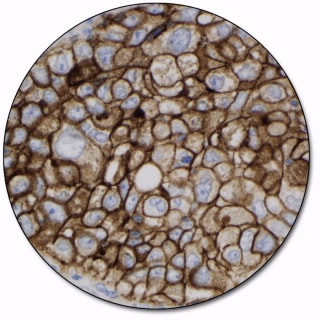 PD-L1 IHC 22C3 pharmDx for Autostainer Link 48