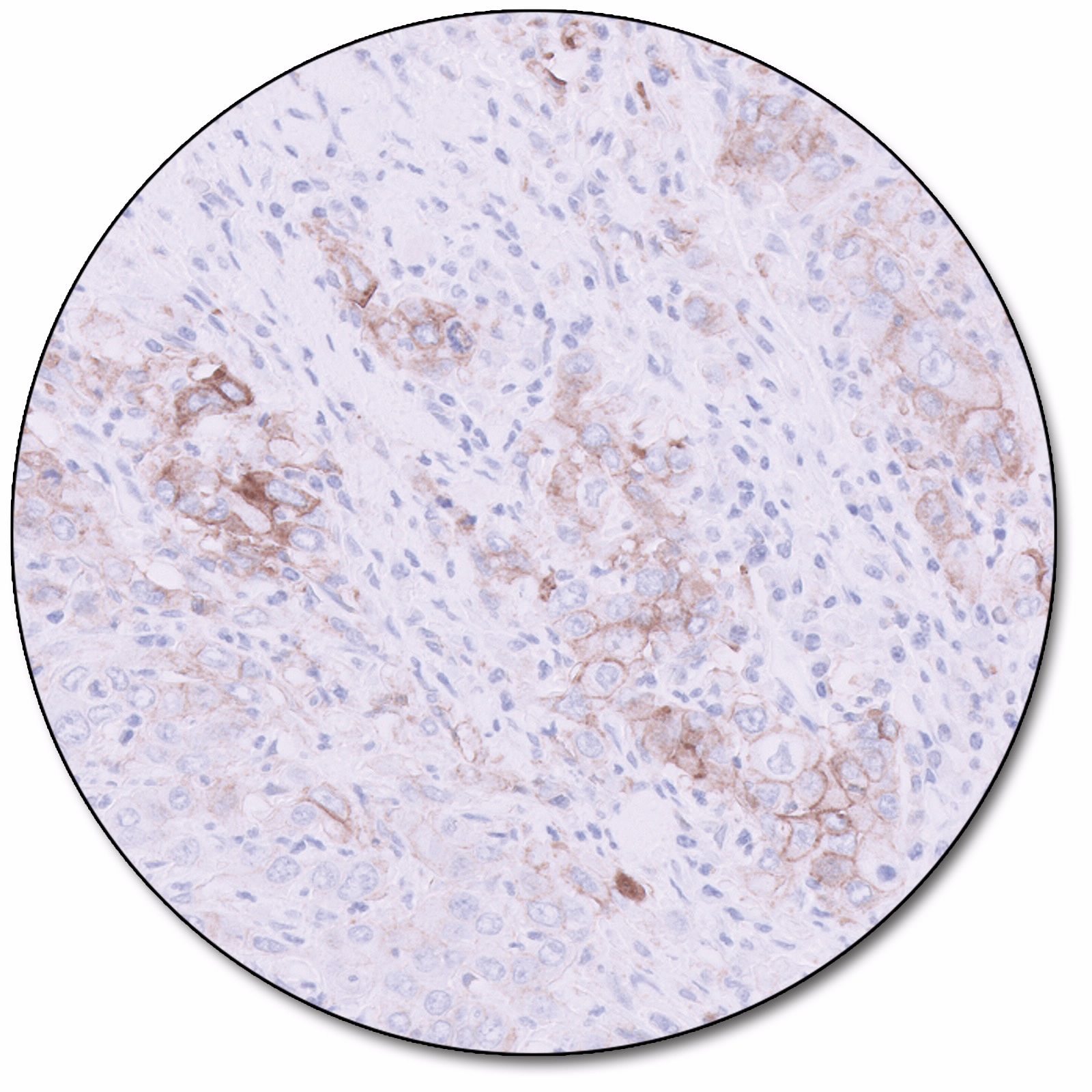 PD-L1 IHC 22C3 pharmDx for Autostainer Link 48