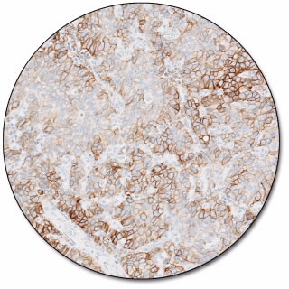 PD-L1 IHC 22C3 pharmDx for Autostainer Link 48