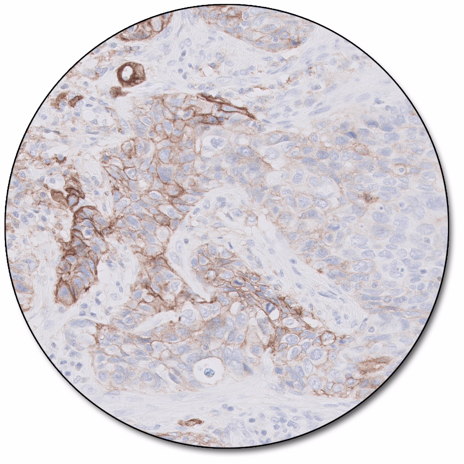 PD-L1 IHC 22C3 pharmDx for Autostainer Link 48